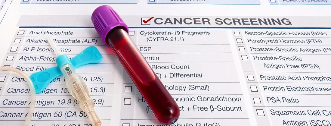 The Importance of Cancer Screening in Preventing and Detecting Early-Stage Cancer